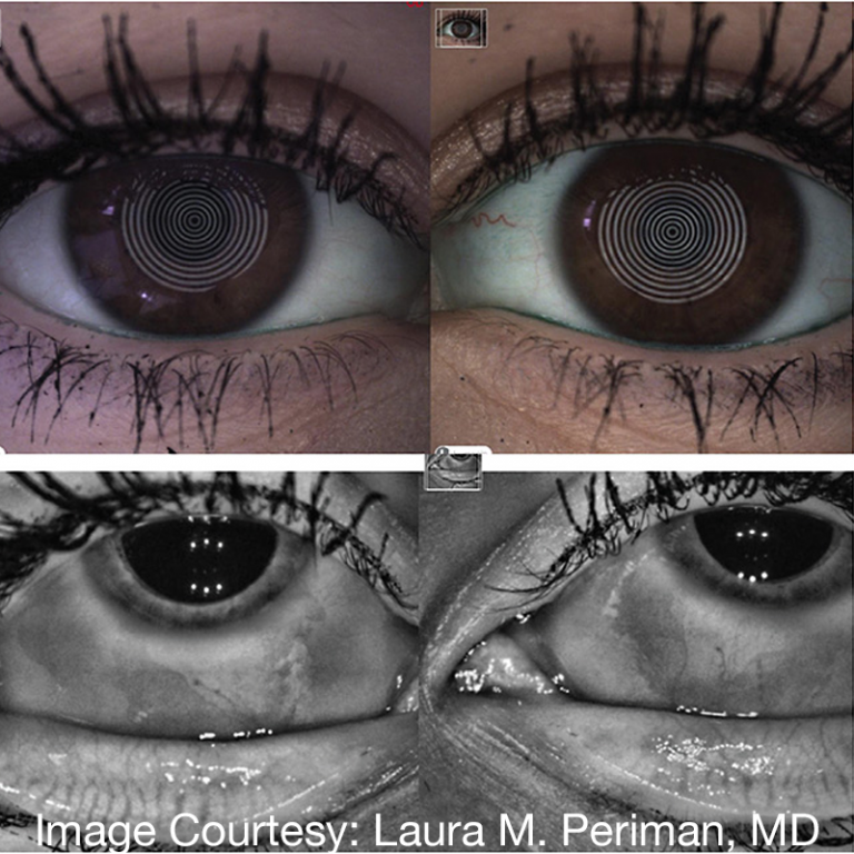 Drops & Eyelash Cosmetics with Laura M. Periman, MD